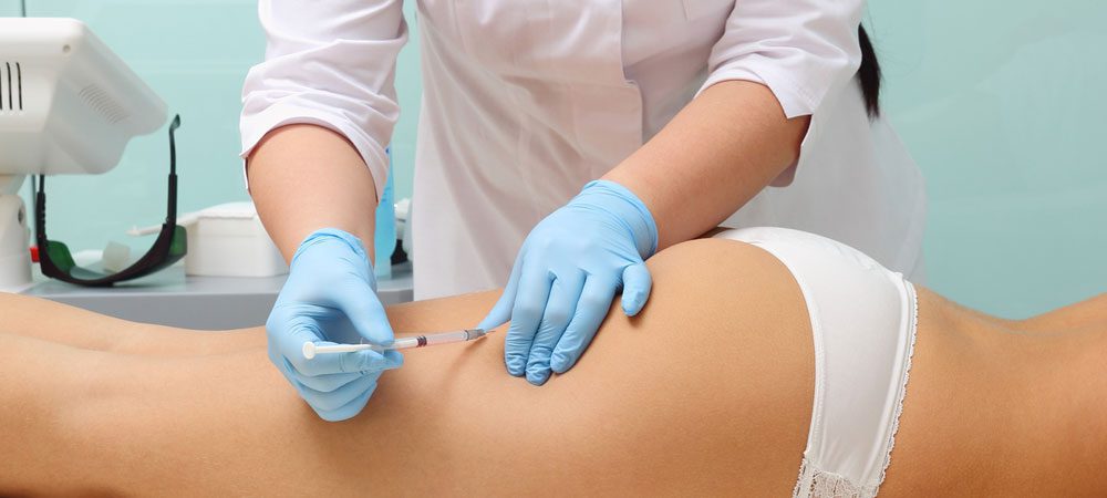 Μεσοθεραπεια Κυτταριτιδας