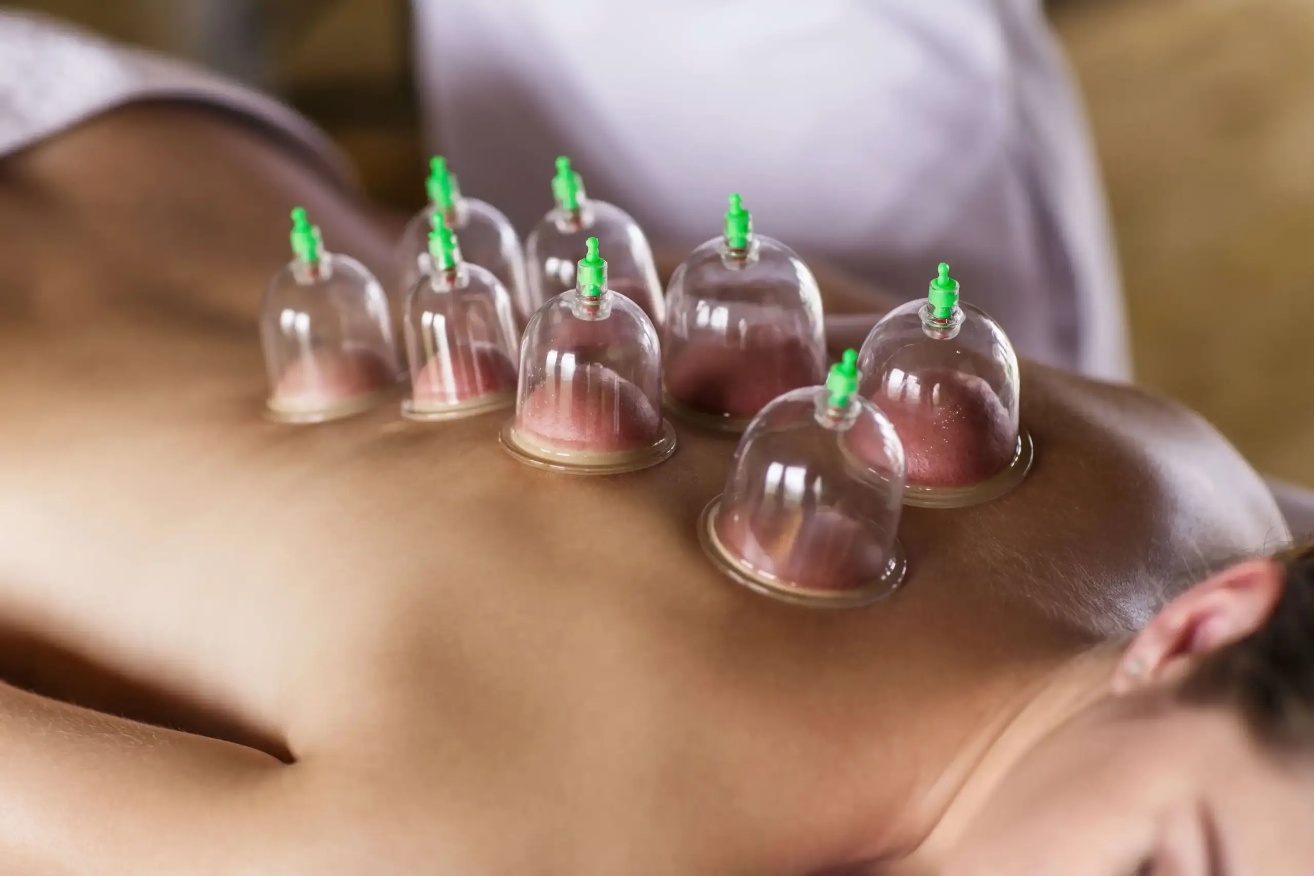 Cupping massage